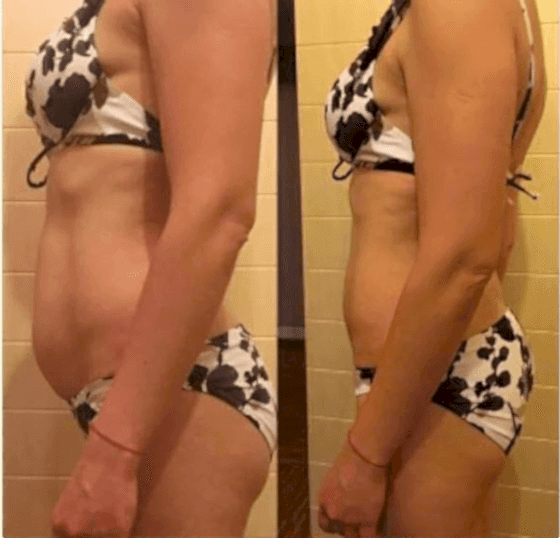 омоложение лица