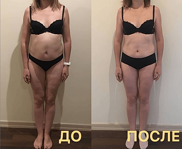 омоложение лица