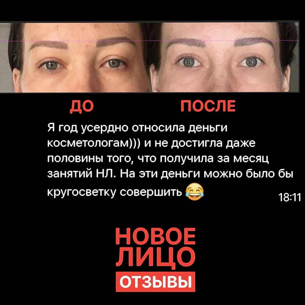 омоложение лица