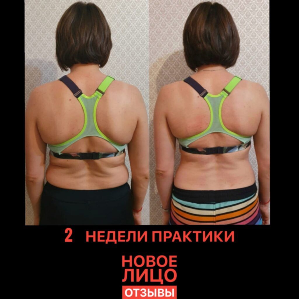 омоложение лица