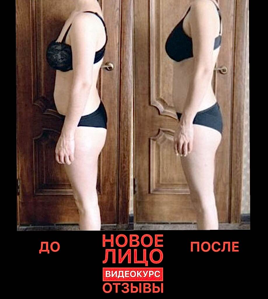 омоложение лица