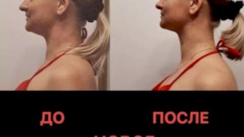 новое лицо омоложение алматы