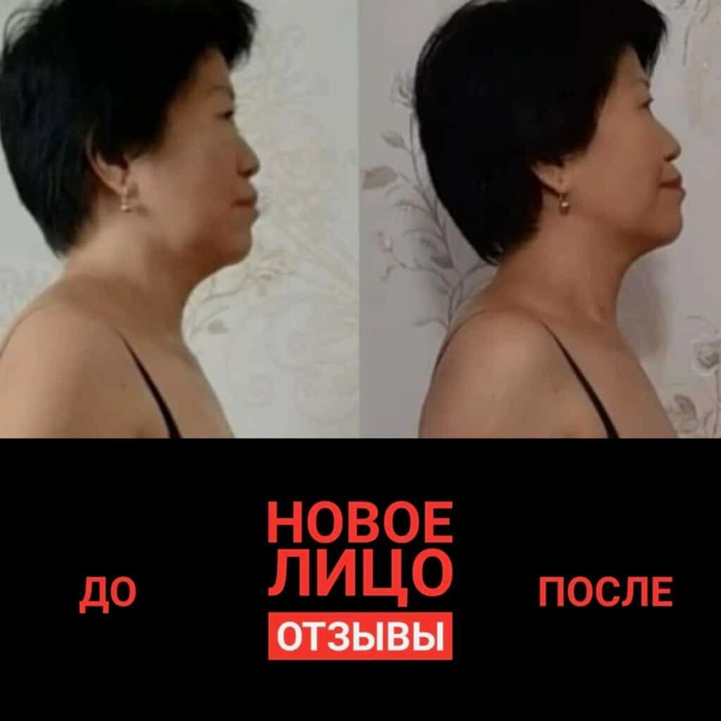 НОВОЕ ЛИЦО: ПРОТИВОПОКАЗАНИЯ К ЗАНЯТИЯМ