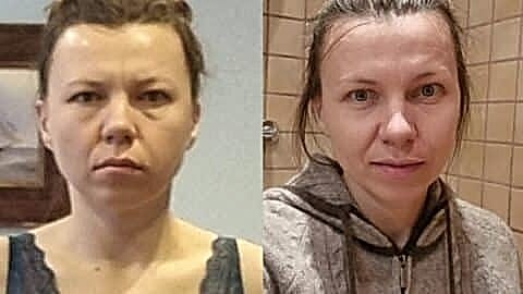 новое лицо естественное омоложение алматы алия мусина