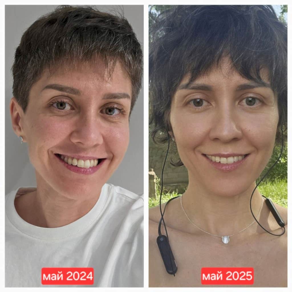 клуб новое лицо естественное омоложение алия мусина