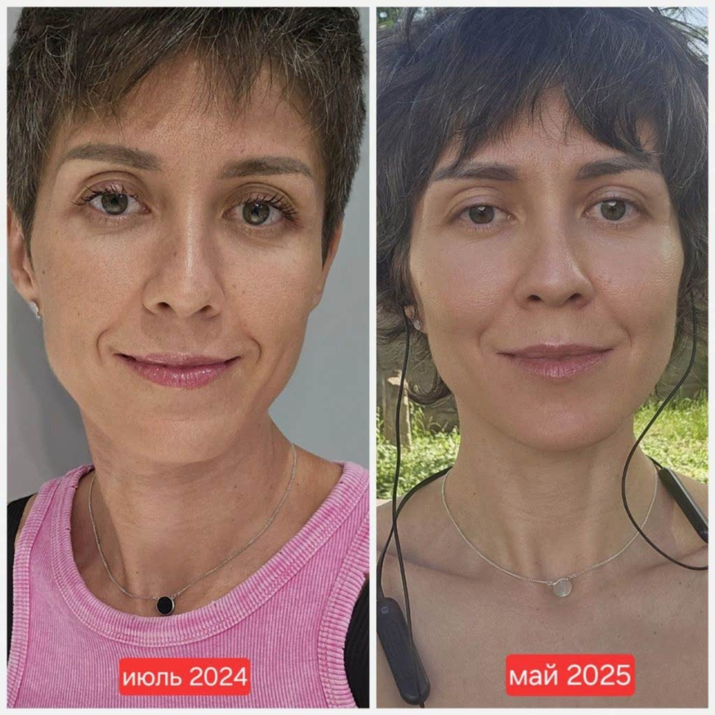 клуб новое лицо естественное омоложение алия мусина