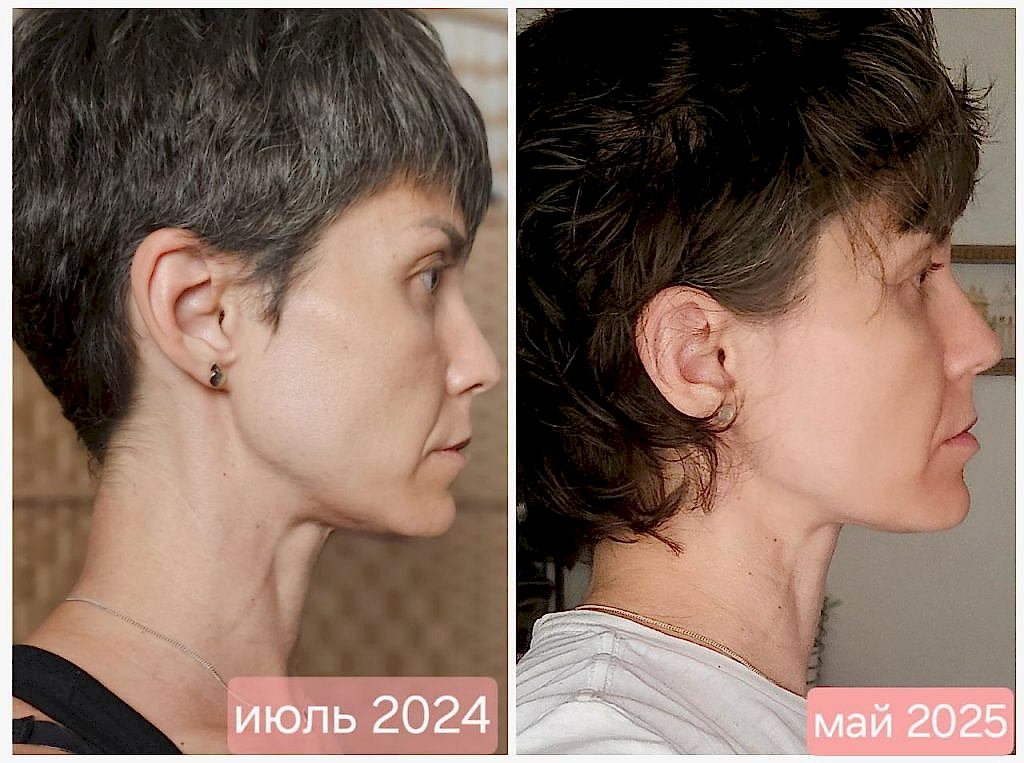 клуб новое лицо естественное омоложение алия мусина