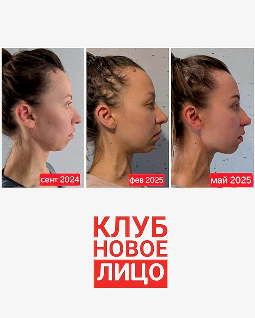 клуб новое лицо естественное омоложение алия мусина
