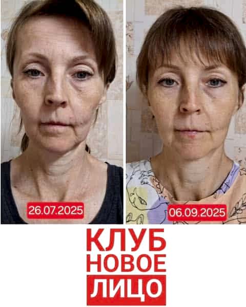 клуб новое лицо естественное омоложение алия мусина