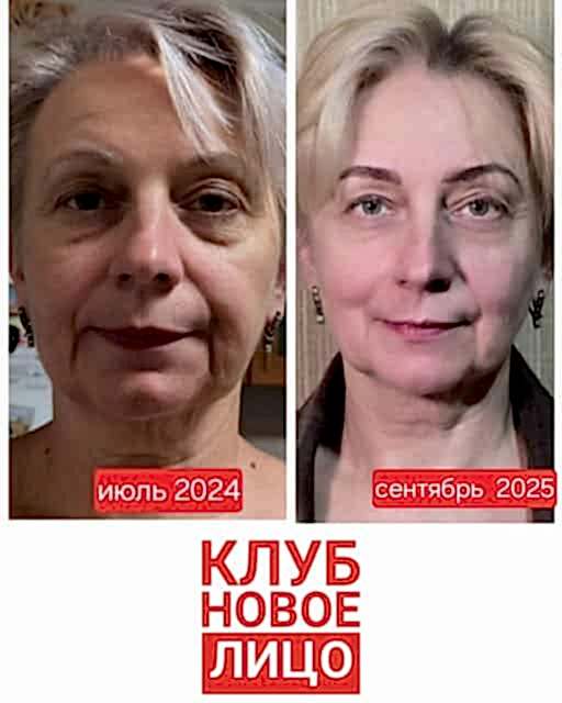 клуб новое лицо естественное омоложение алия мусина